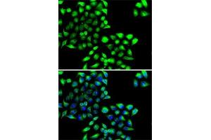 Immunofluorescence analysis of MCF7 cells using COPS6 antibody (ABIN6130710, ABIN6138885, ABIN6138886 and ABIN6222868). (COPS6 antibody  (AA 58-327))