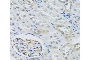 Immunohistochemistry of paraffin-embedded Rat kidney using SLC29A1 Polyclonal Antibody at dilution of 1:100 (40x lens). (SLC29A1 antibody)