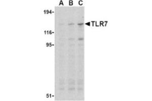 Image no. 1 for anti-Toll-Like Receptor 7 (TLR7) (Middle Region) antibody (ABIN265146) (TLR7 antibody  (Middle Region))