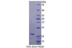 SDS-PAGE analysis of Human S100A15 Protein. (S100A7A Protein)