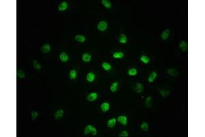 Immunofluorescence staining of A549 cells with ABIN7127748 at 1:100,counter-stained with DAPI. (Recombinant SMAD2 antibody  (pSer255))