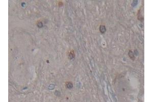 DAB staining on IHC-P; Samples: Rat Spinal cord Tissue (CDNF antibody  (AA 20-183))
