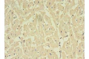 Immunohistochemistry of paraffin-embedded human heart tissue using ABIN7161713 at dilution of 1:100 (NOSTRIN antibody  (AA 1-322))