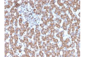 Formalin-fixed, paraffin-embedded human Liver stained with Prohibitin Mouse Monoclonal Antibody (PHB/3231). (Prohibitin antibody  (AA 167-261))