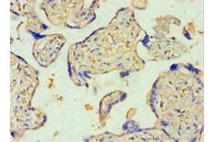 Immunohistochemistry of paraffin-embedded human placenta tissue using ABIN7170965 at dilution of 1:100 (SULT2B1 antibody  (AA 1-365))