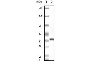 Western Blot showing calcyclin antibody used against truncated calcyclin recombinant protein. (S100A6 antibody)