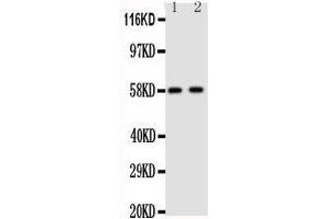 Anti-Aromatase antibody, Western blotting Lane 1: Human Placenta Tissue Lysate Lane 2: Human Placenta Tissue Lysate (Aromatase antibody  (C-Term))