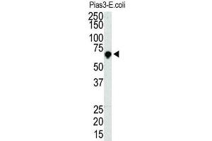 Western Blotting (WB) image for anti-Protein Inhibitor of Activated STAT, 3 (PIAS3) antibody (ABIN5016360) (PIAS3 antibody)