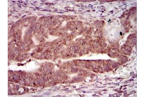 Immunohistochemistry (IHC) image for anti-Protein Kinase, CAMP-Dependent, Catalytic, gamma (PRKACG) antibody (ABIN969365)