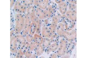 IHC-P analysis of Rat Tissue, with DAB staining. (CUBN antibody  (AA 3157-3274))
