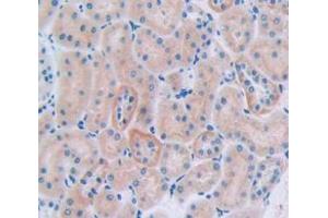 IHC-P analysis of Rat Tissue, with DAB staining. (CUBN antibody  (AA 3157-3274))