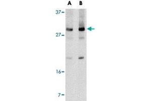 Western blot analysis of Klra2 in mouse spleen tissue lysate with Klra2 polyclonal antibody  at (A) 0.