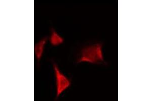 ABIN6269252 staining Hela by IF/ICC. (MTOR antibody)