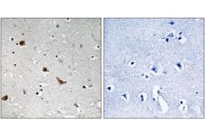 Immunohistochemistry analysis of paraffin-embedded human brain, using IKK-gamma (Phospho-Ser376) Antibody. (IKBKG antibody  (pSer376))