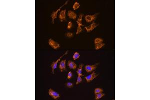 Immunofluorescence analysis of U2OS cells using TRH Rabbit pAb (ABIN7270826) at dilution of 1:100. (TRH antibody  (AA 100-200))