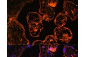Immunofluorescence analysis of Human placenta cells using LDB3 Polyclonal Antibody at dilution of 1:100. (LIM Domain Binding 3 Protein antibody)