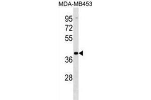 Western Blotting (WB) image for anti-Vomeronasal 1 Receptor 2 (VN1R2) antibody (ABIN3000165) (VN1R2 antibody)