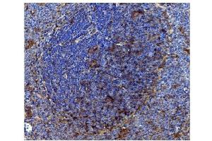 IHC analysis of CD82 using anti-CD82 antibody (ABIN7601301).