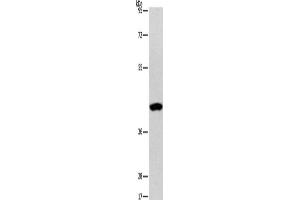 Western Blotting (WB) image for anti-Alanine-Glyoxylate Aminotransferase 2-Like 2 (AGXT2L2) antibody (ABIN2429084) (AGXT2L2 antibody)