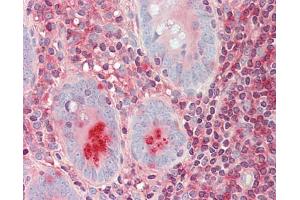 S100G antibody