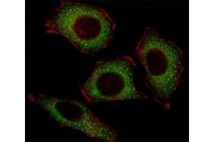 Fluorescent image of U251 cell stained with p65 antibody at 1:25.