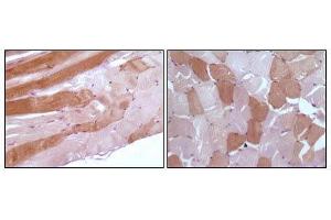 Immunohistochemical analysis of paraffin-embedded human skeletal muscle tissue showing cytoplasmic localization using anti-Myoglobin antibody with DAB staining.