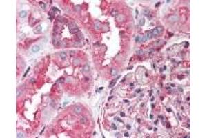 Immunohistochemistry (IHC) image for anti-Heat Shock Protein 90kDa beta (Grp94), Member 2, Pseudogene (HSP90B2P) (AA 289-300) antibody (ABIN2470237) (HSP90B2P antibody  (AA 289-300))