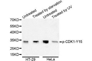 Western Blotting (WB) image for anti-Cyclin-Dependent Kinase 1 (CDK1) (pTyr15) antibody (ABIN3019443) (CDK1 antibody  (pTyr15))