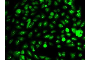 Immunofluorescence analysis of HeLa cell using IDH1 antibody. (IDH1 antibody  (AA 1-414))