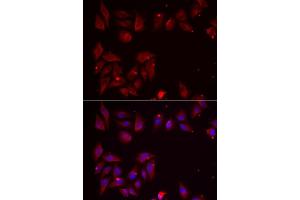 Immunofluorescence analysis of U2OS cells using PDXK antibody. (PDXK antibody  (AA 1-312))