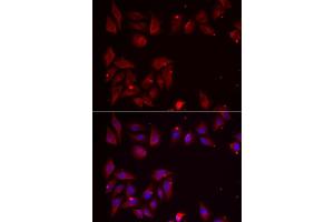 Immunofluorescence analysis of U2OS cells using PDXK antibody. (PDXK antibody  (AA 1-312))