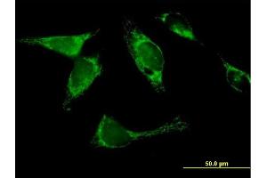 Immunofluorescence of  purified  MaxPab antibody to YARS2 on HeLa cell. (YARS2 antibody  (AA 1-477))