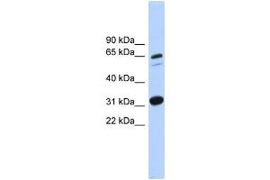 WB Suggested Anti-ITFG3 Antibody Titration: 0. (ITFG3 antibody  (Middle Region))