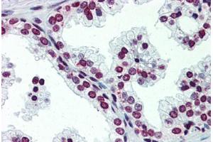 Human Prostate (formalin-fixed, paraffin-embedded) stained with ARID5A antibody ABIN462249 followed by biotinylated goat anti-rabbit IgG secondary antibody ABIN481713, alkaline phosphatase-streptavidin and chromogen. (ARID5A antibody  (C-Term))