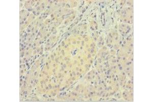 Immunohistochemistry of paraffin-embedded human pancreatic tissue using ABIN7165325 at dilution of 1:100 (LMAN1L antibody  (AA 26-462))