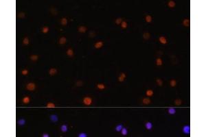 Immunofluorescence analysis of C6 cells using COPS5 Polyclonal Antibody at dilution of 1:100. (COPS5 antibody)