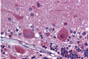Human Brain, Cerebellum: Formalin-Fixed, Paraffin-Embedded (FFPE) (PDGFRA antibody  (AA 1035-1053))