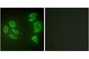 Immunofluorescence analysis of HepG2 cells, using MLTK Antibody. (ZAK antibody  (AA 701-750))