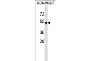 Western blot analysis in MDA-MB435 cell line lysates (35ug/lane). (TUBA3C antibody  (C-Term))