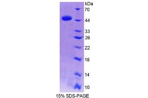 SDS-PAGE analysis of Human TRIP6 Protein.