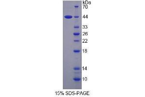 SDS-PAGE (SDS) image for Spermine Synthase, SMS (SMS) (AA 2-366) protein (His tag) (ABIN6239210)