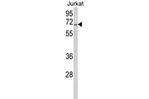 Western blot analysis of RBM14 Antibody (Center) in Jurkat cell line lysates (35ug/lane).