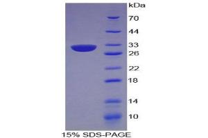 SDS-PAGE (SDS) image for Centromere Protein I (CENPI) (AA 292-528) protein (His tag) (ABIN2124301)