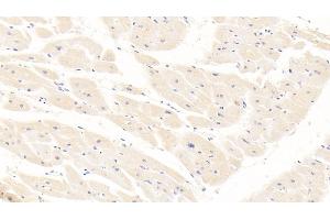 Detection of ALB in Human Cardiac Muscle Tissue using Monoclonal Antibody to Albumin (ALB) (Albumin antibody)