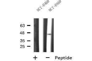 Western blot analysis of PDHA2 expression in NCI-H460 cell line lysates,The lane on the left is treated with the antigen-specific peptide. (PDHA2 antibody  (C-Term))