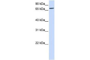 IL1RAPL2 antibody used at 1 ug/ml to detect target protein. (IL1RAPL2 antibody  (Middle Region))
