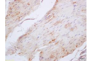 Formalin-fixed and paraffin embedded mouse stomach labeled with Anti-Elastin Polyclonal Antibody, Unconjugated (ABIN1386226) at 1:200 followed by conjugation to the secondary antibody and DAB staining (Elastin antibody  (AA 101-200))