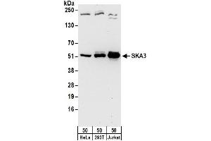 Western Blotting (WB) image for anti-Spindle and Kinetochore Associated Complex Subunit 3 (SKA3) (AA 362-412) antibody (ABIN7450733)