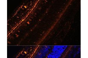 Immunofluorescence analysis of Rat eye using KCNS2 Polyclonal Antibody at dilution of 1:100 (40x lens). (KCNS2 antibody)