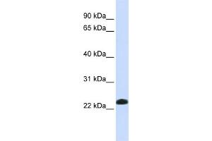 WB Suggested Anti-CAV2 Antibody Titration:  0.
